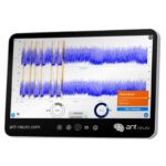 Monitor Néo de aEEG-EEG para UCI neonatal, permitiendo la monitorización continua de la actividad cerebral en recién nacidos críticos.