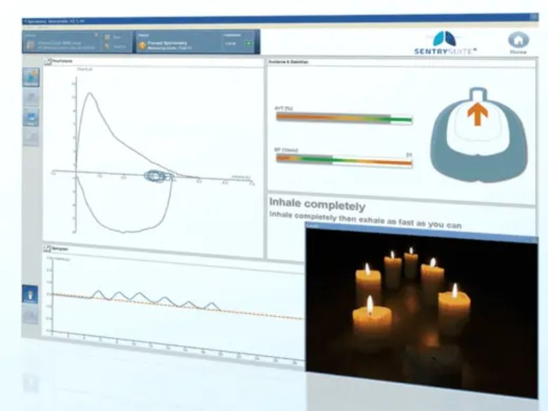 SentrySuite™: La Solución Integral para el Monitoreo y Control de Laboratorios de Función Pulmonar