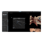 Simulador Ultrasound Mentor para punción eco-guiada del plexo braquial, entrenamiento en anestesia regional y bloqueos nerviosos.