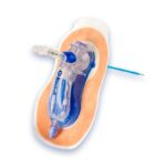 Rocket System PleuralVent para drenaje pleural, manejo seguro de neumotórax y derrames pleurales en entornos clínicos y hospitalarios.