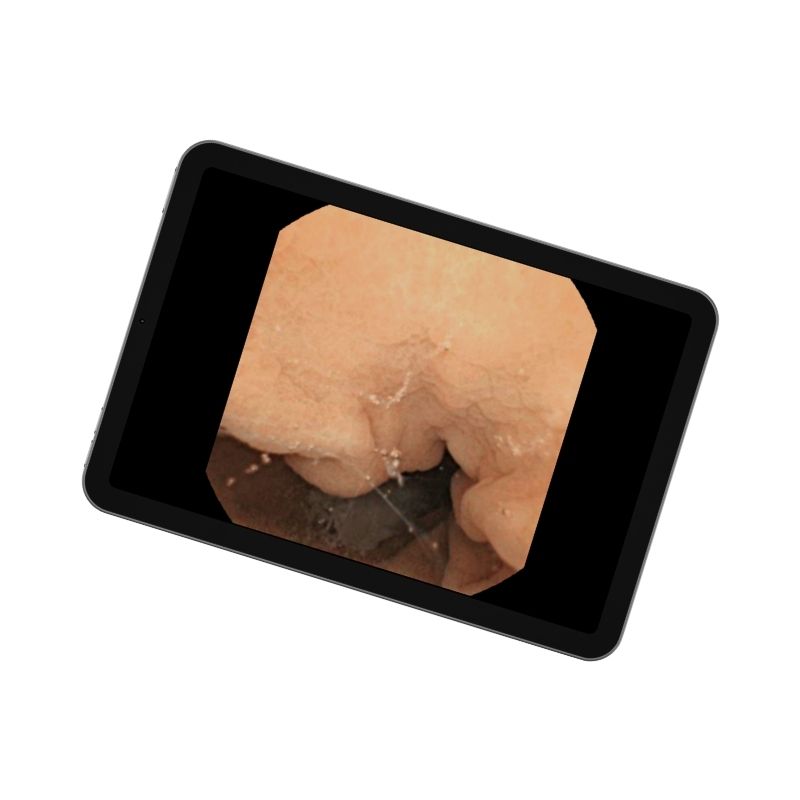 Accesorios para capsula endoscópica - Tablet
